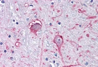 Immunohistochemistry-Paraffin: GABA-AR alpha 3 Antibody [NBP3-14326]